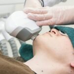 ヒゲ脱毛を受ける男性