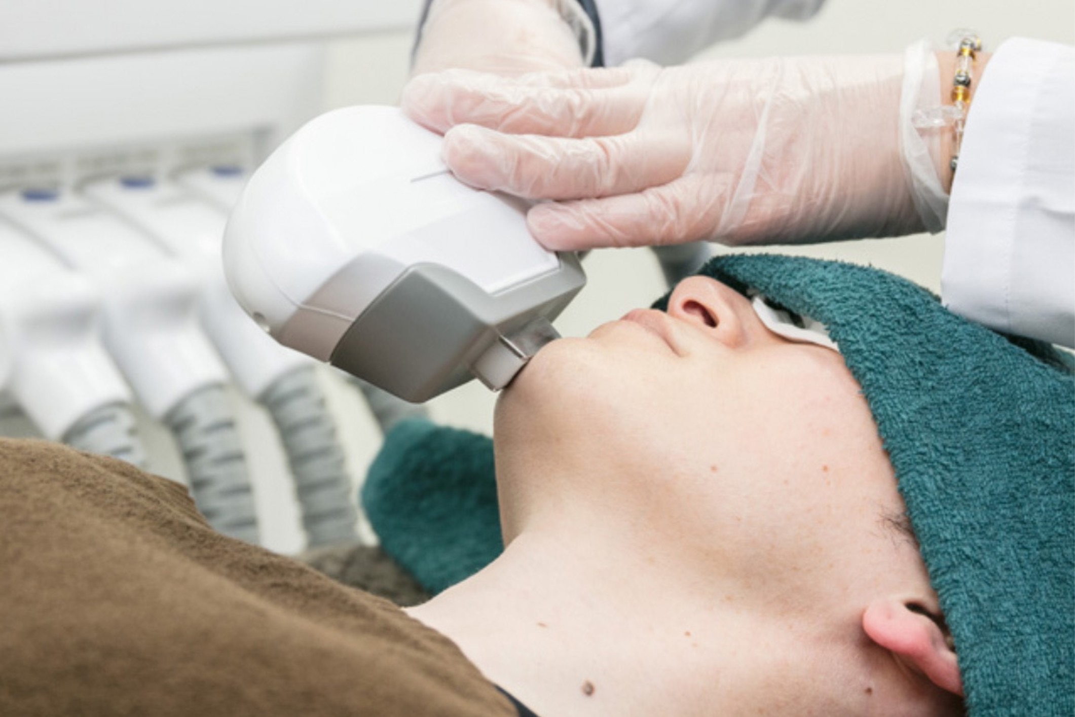 ヒゲ脱毛を受ける男性